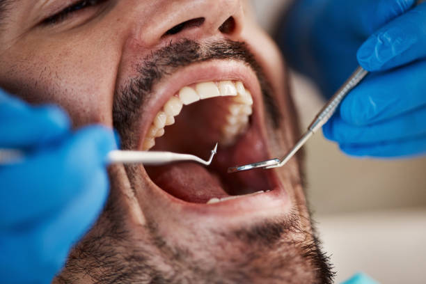 Best Emergency Root Canal Treatment in Winfield, IL