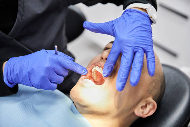 Best Emergency Dentist for Knocked-Out Tooth in Winfield, IL